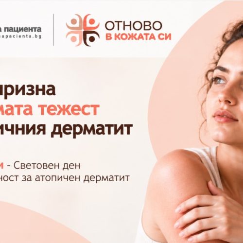 Светът призна невидимата тежест на атопичния дерматит