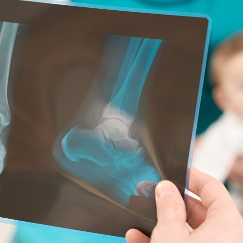 Closeup of doctor hand holding radiograph of child right leg in front of little patient sitting on mother lap